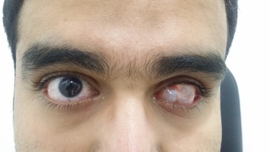 صورة لحالة قبل , وفيديو للحالة بعد
